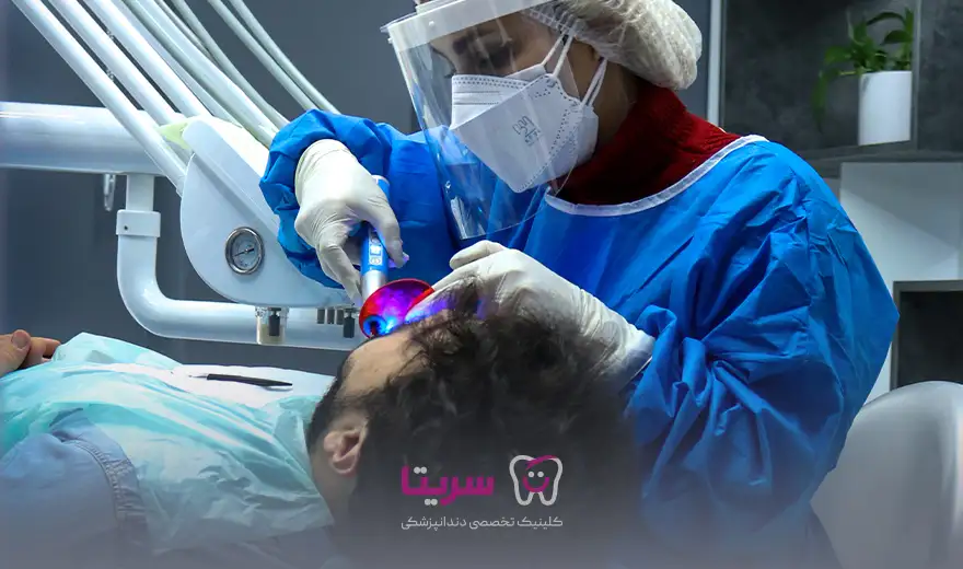 مرحله باندینگ دندان قبل از کامپوزیت دندان