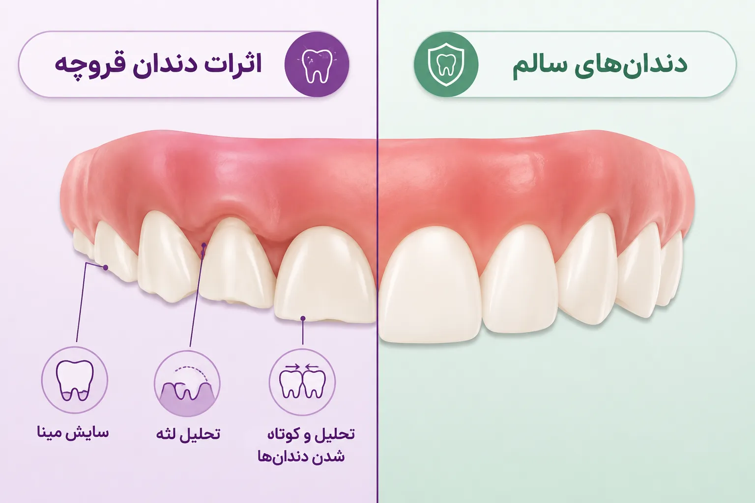 اثرات و عوارض دندان قروچه