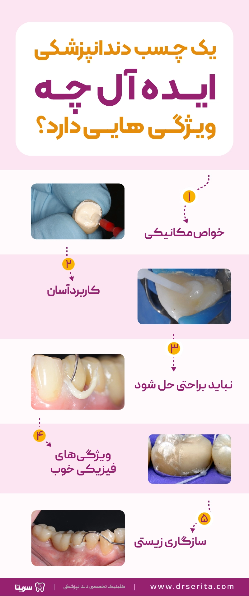 اینفوگرافیک ویژگی های چسپ ایده آل دندانپزشکی شامل 5 مورد