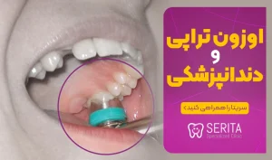 کاربرد اوزون تراپی در دندانپزشکی