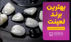 بهترین مارک، جنس و برند لمینت دندان