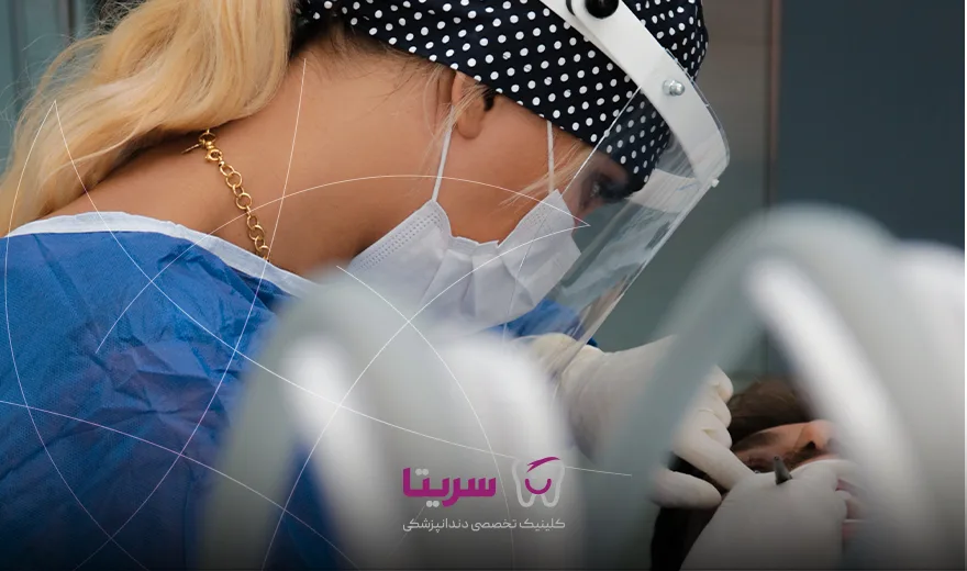 انجام لمینت دندان در کلینیک تخصصی سریتا توسط پزشک متخصص لمینت