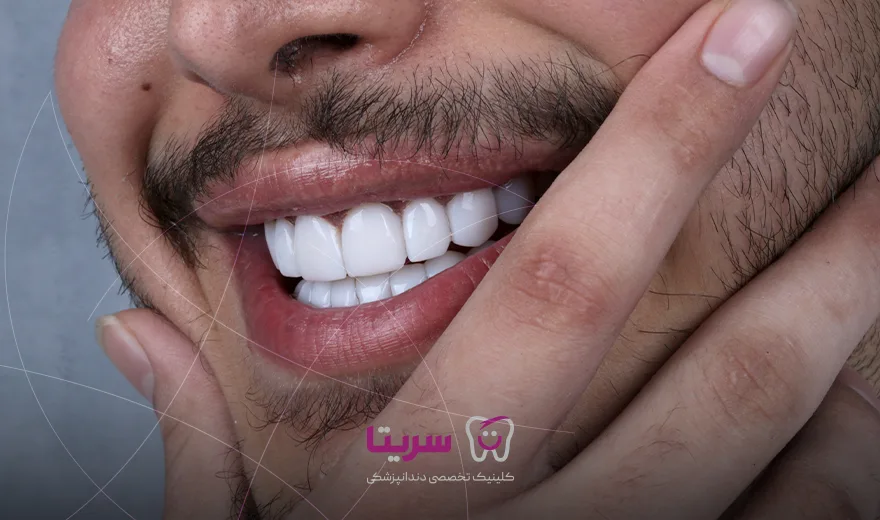 لمیت دندان در کلینیک دندانپزشکی سریتا