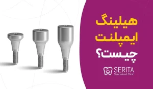 ="هیلینگ