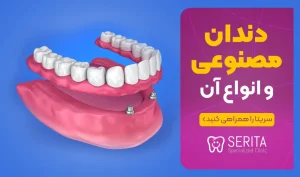 دندان مصنوعی یا پروتز دندان و انواع آنها