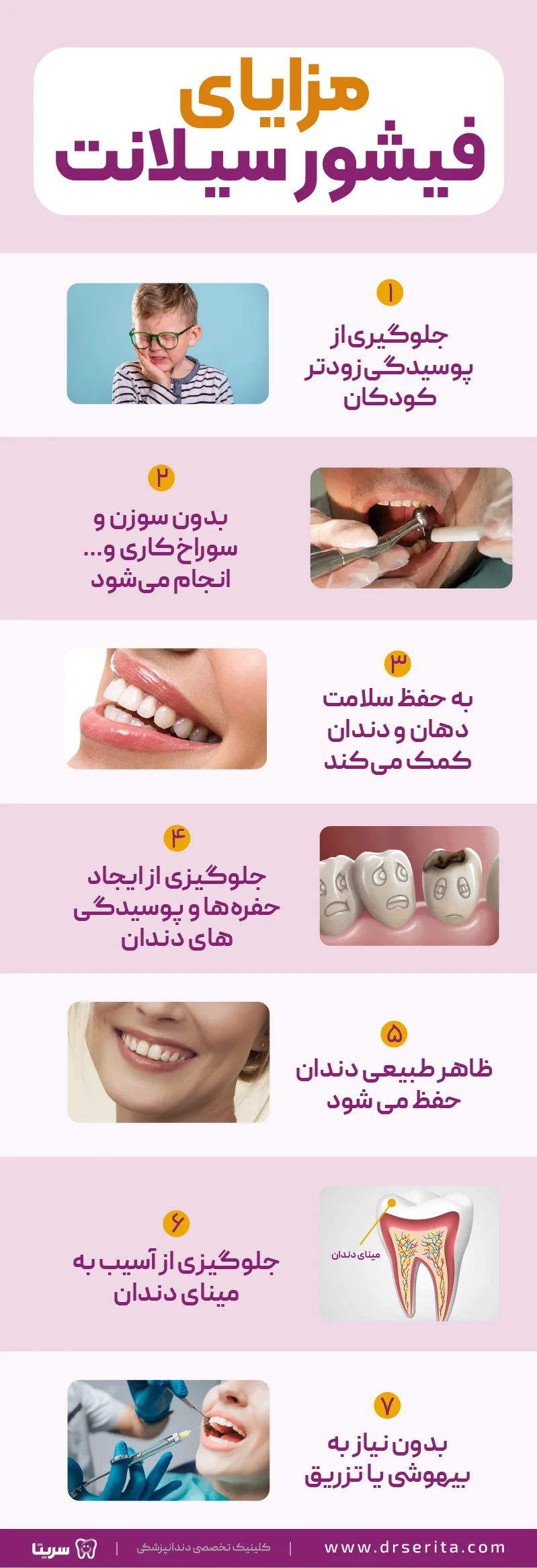 هفت مزیت فیشور سیلانت برای دندان به صورت اینفوگرافیک