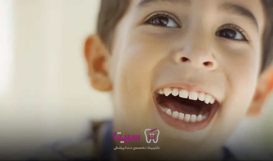 جلوگیری از تشکیل جرم روی دندان کودک