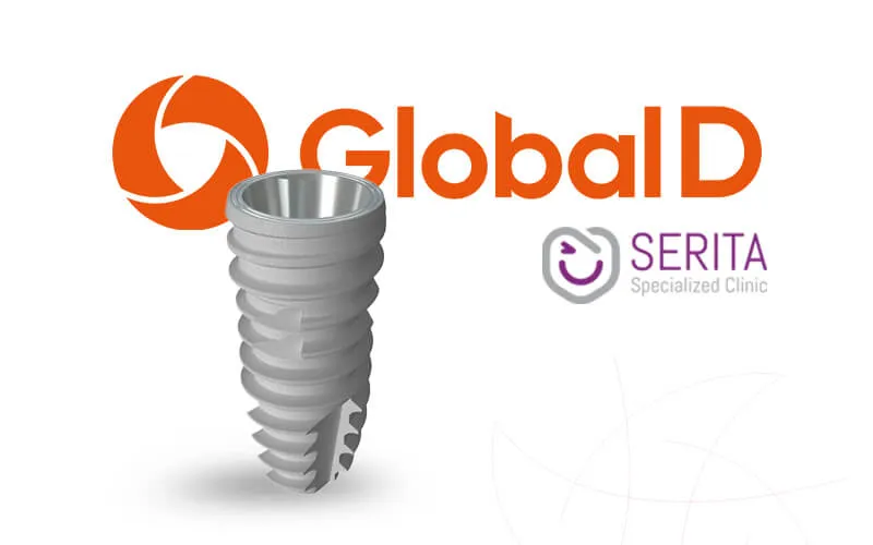  ایمپلنت گلوبال دی (Globald)