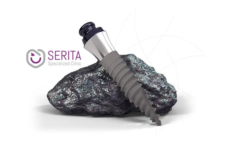 ایمپلنت اشترومن از تیتانیوم معمولا ساخته میشود.