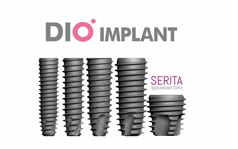انواع ایمپلنت دیو dio