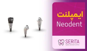 بررسی ایمپلنت نئودنت (NeoDent) به همراه قیمت