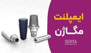 ="ایمپلنت