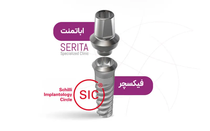 اباتمنت و ایمپلنت SIC