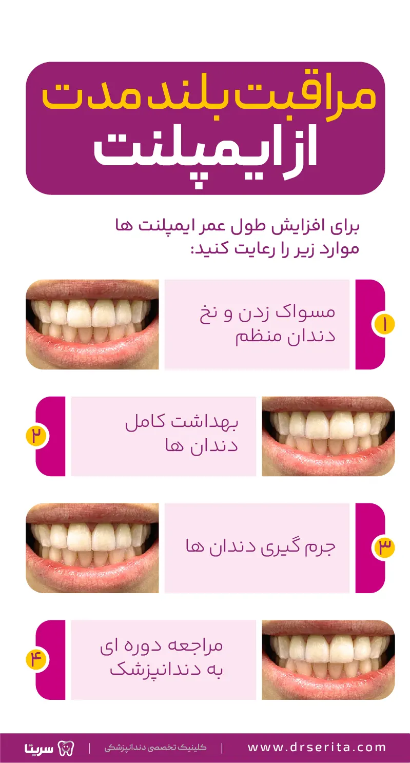 مراقبت های طولانی مدت از ایمپلنت دندان (اینفوگرافیک)