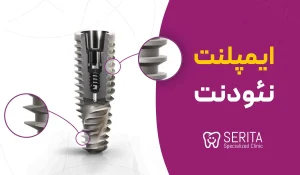 ="ایمپلنت
