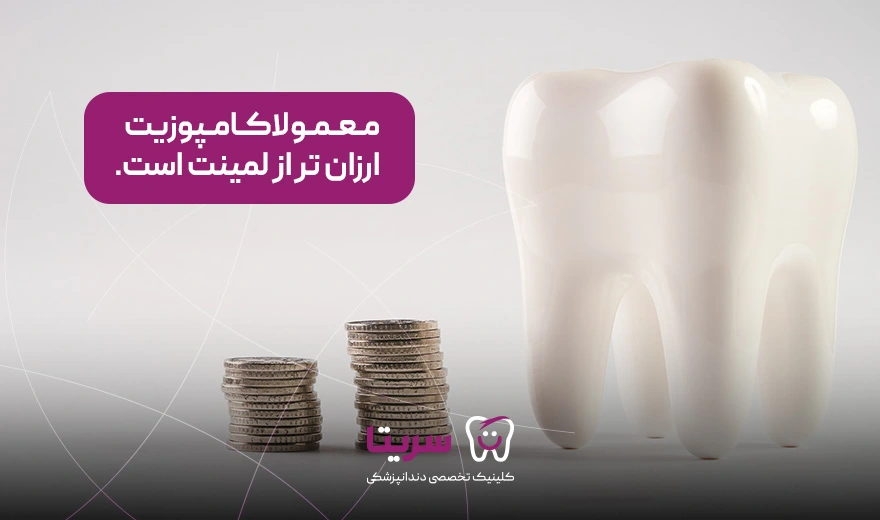 کامپوزیت دندان ارزانتر از لمینت دندان است