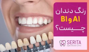 تفاوت رنگ دندان A1 و B1 چیست؟