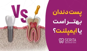 ="پست