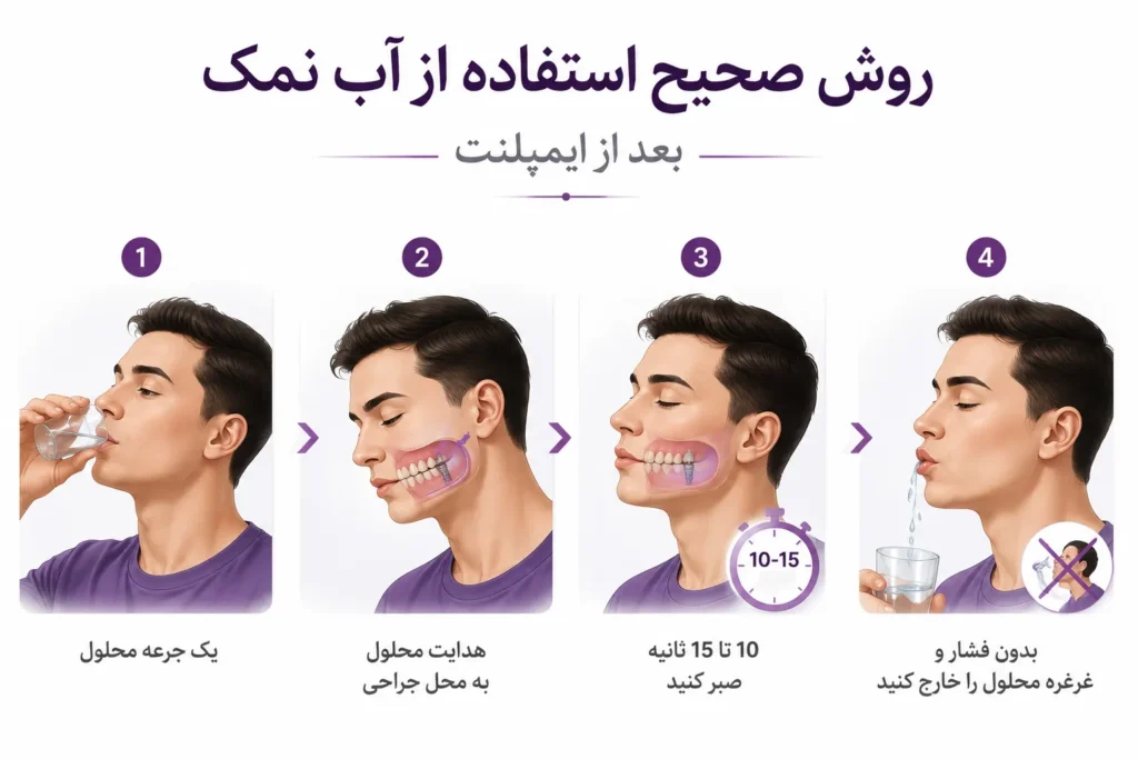 روش صحیح استفاده از آب نمک بعد از ایمپلنت