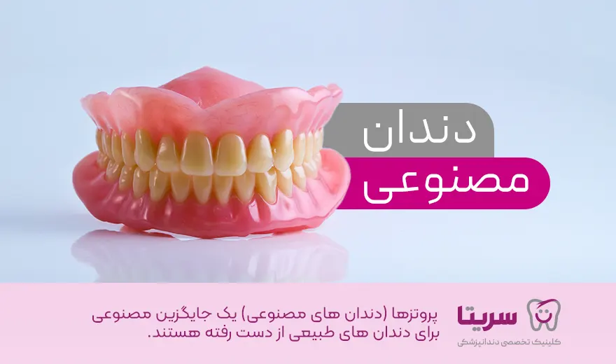 دندان مصنوعی یا پروتز دندان چیست؟