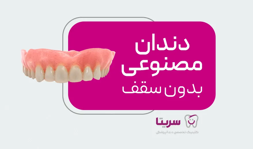 دندان مصنوعی فک بالا بدون سقف که با ایمپلنت به دهان متصل می شود