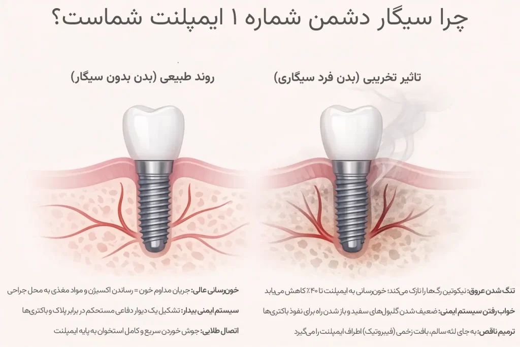 اینفوگرافیک تاثیر سیگار بر ایمپلنت دندان
