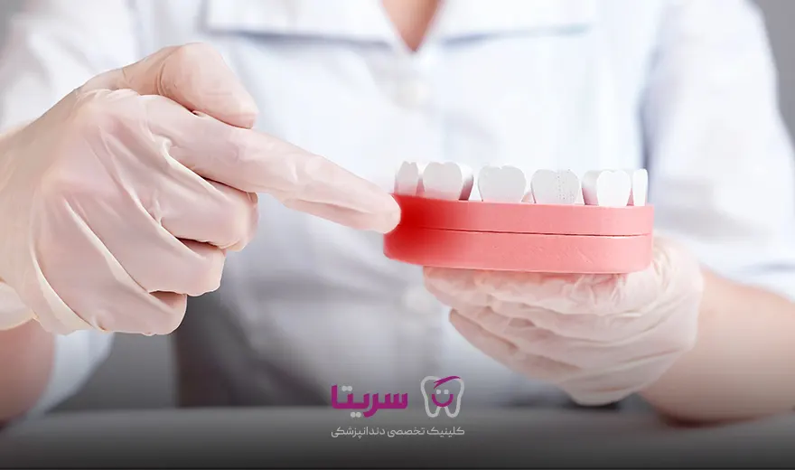التهاب و ورم لثه از عوارض دندان مصنوعی است