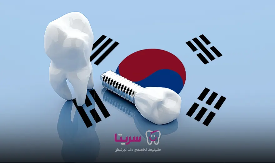 ایمپلنت دندان کره ای