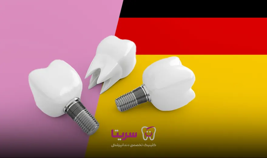 ایمپلنت دندان آلمانی