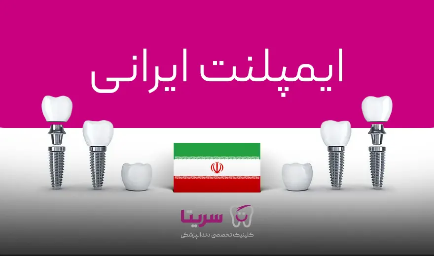 ایمپلنت ایرانی به همراه قیمت ایمپلنت ایرانی