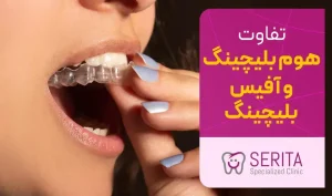 تفاوت آفیس بلیچینگ و هوم بلیچینگ