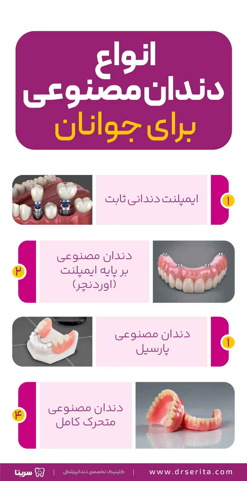 انواع دندان مصنوعی های قابل استفاده برای جوانان