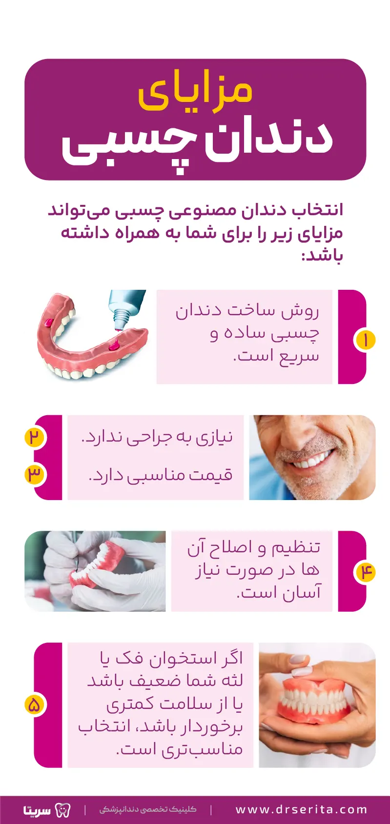 مزایای دندان مصنوعی چسبی