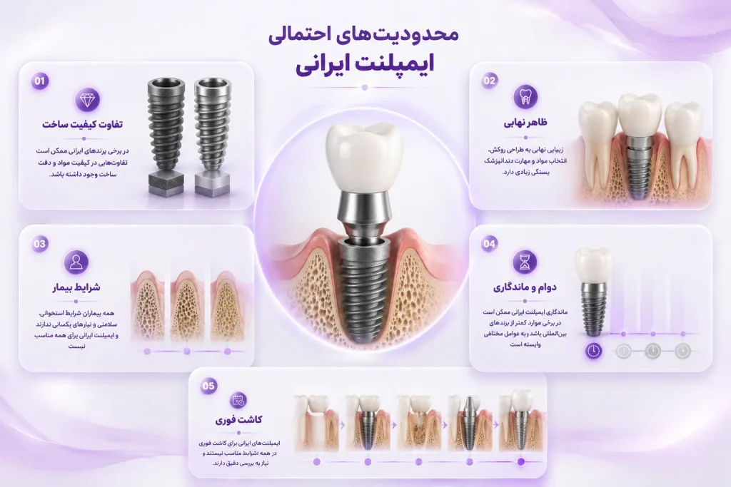 معایب و محدودیت‌های ایمپلنت ایرانی