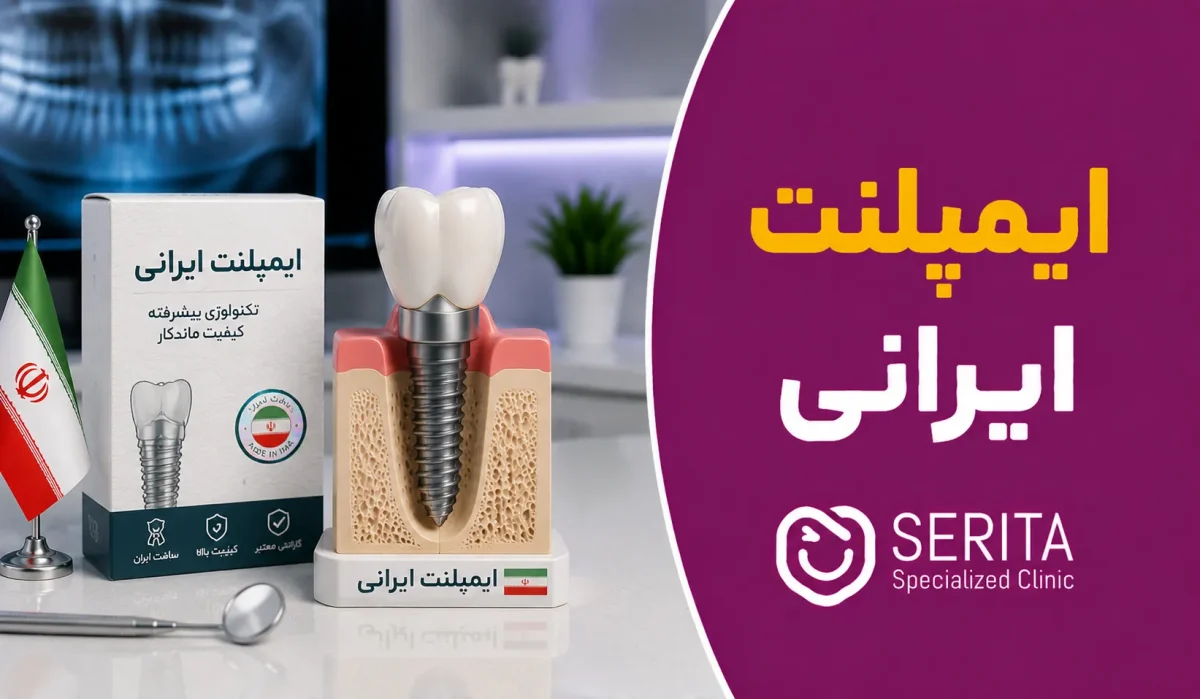 معرفی انواع ایمپلنت ایرانی | عمر، مزایا، معایب و قیمت ایمپلنت ایرانی