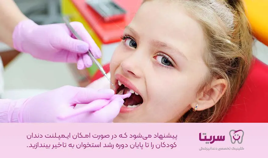 زمان ایمپلنت دندان کودکان