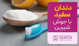 سفید کردن دندان با جوش شیرین در خانه
