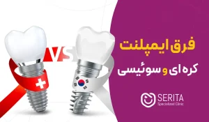 فرق ایمپلنت کره‌ای و سوئیسی | ایمپلنت سوئیسی بهتر است یا کره‌ای؟