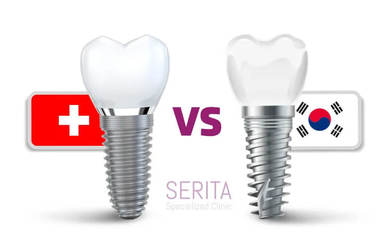 فرق ایمپلنت کرهای و سوئیسی