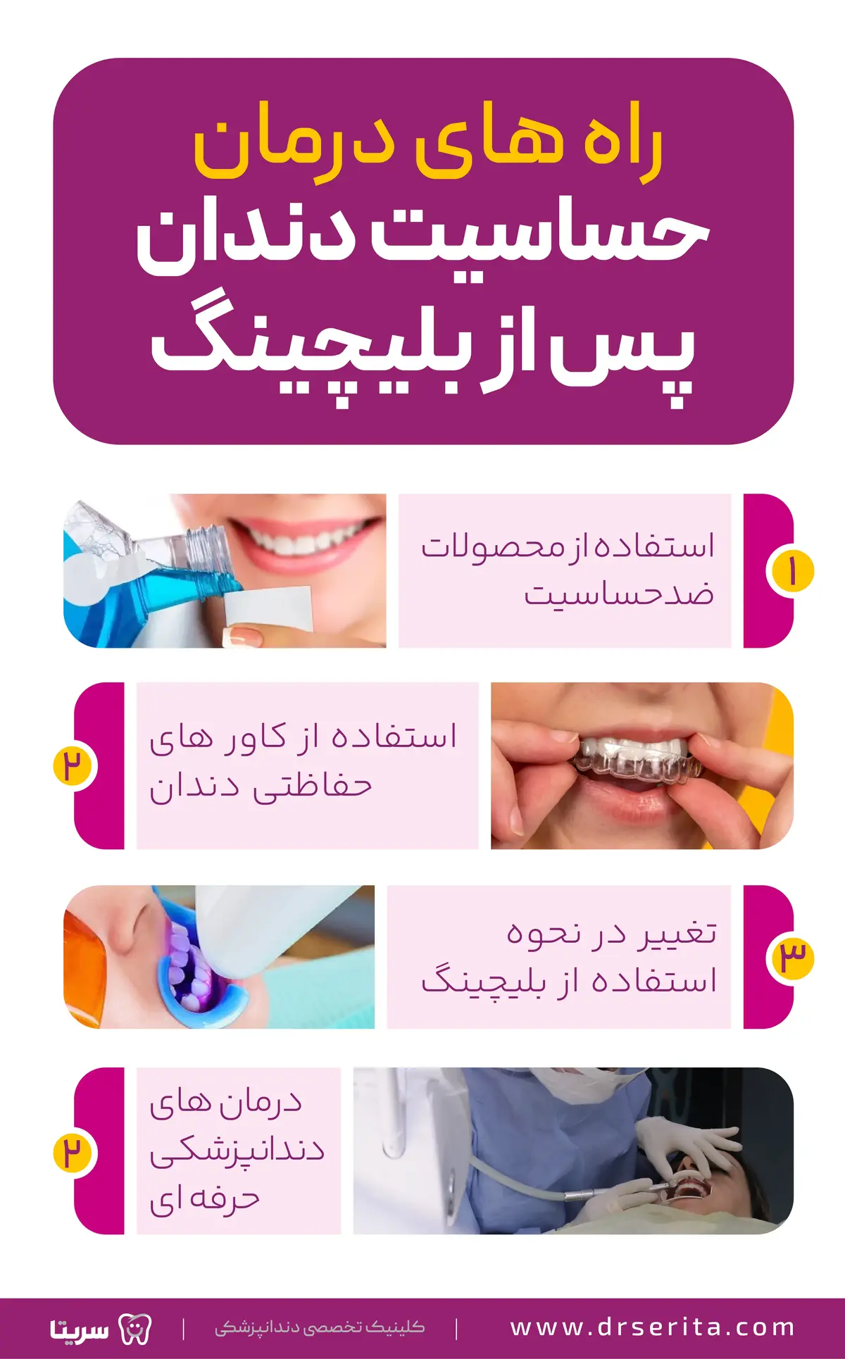 راه های درمان حساسیت بعد از بلیچینگ دندان