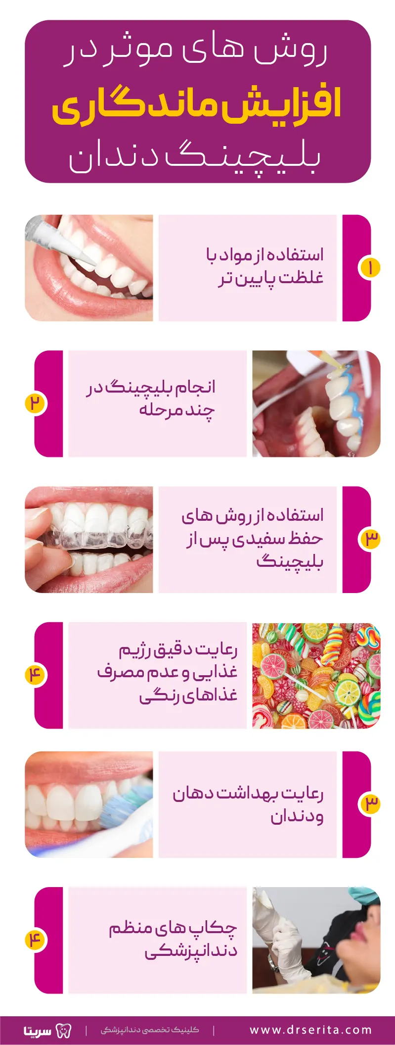 روش های موثر در افزایش ماندگاری بلیچینگ دندان