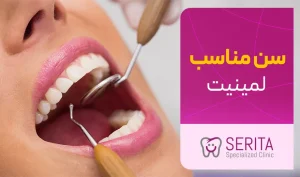 سن مناسب برای لمینت دندان چه سنی است؟