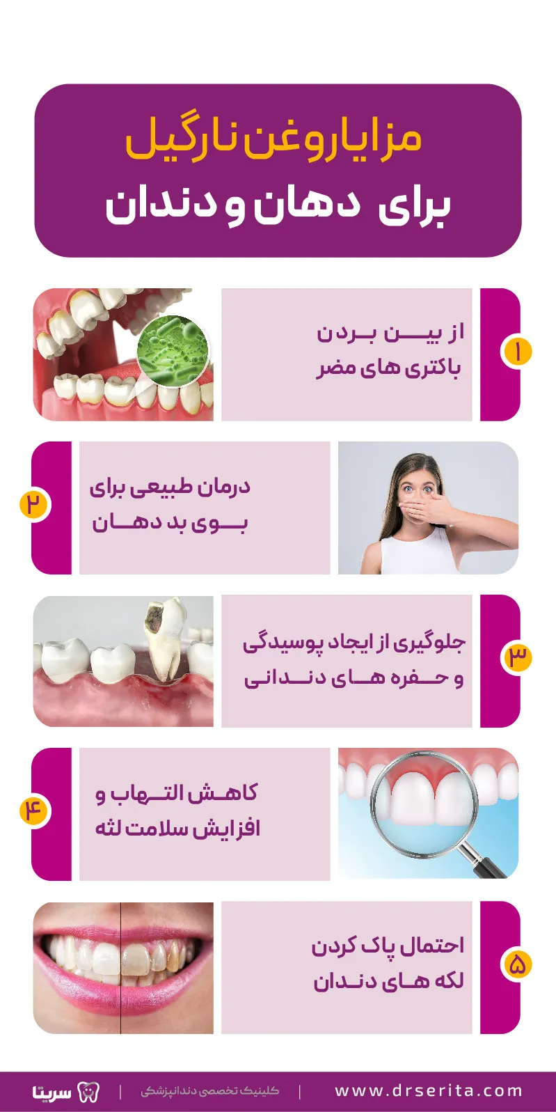 مزایای روغن نارگیل برای دهان و دندان
