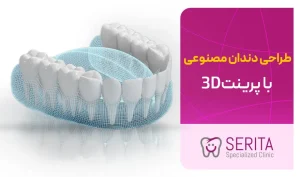 طراحی و تولید دندان مصنوعی با استفاده از پرینت ۳D