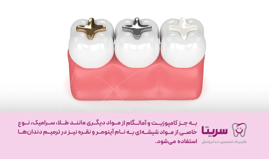 سایر مواد پرکننده دندان