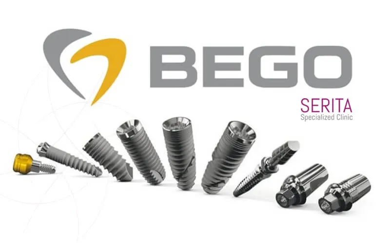 انواع ایمپلنت بگو آلمان