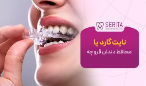 نایت گارد یا محافظ دندان قروچه