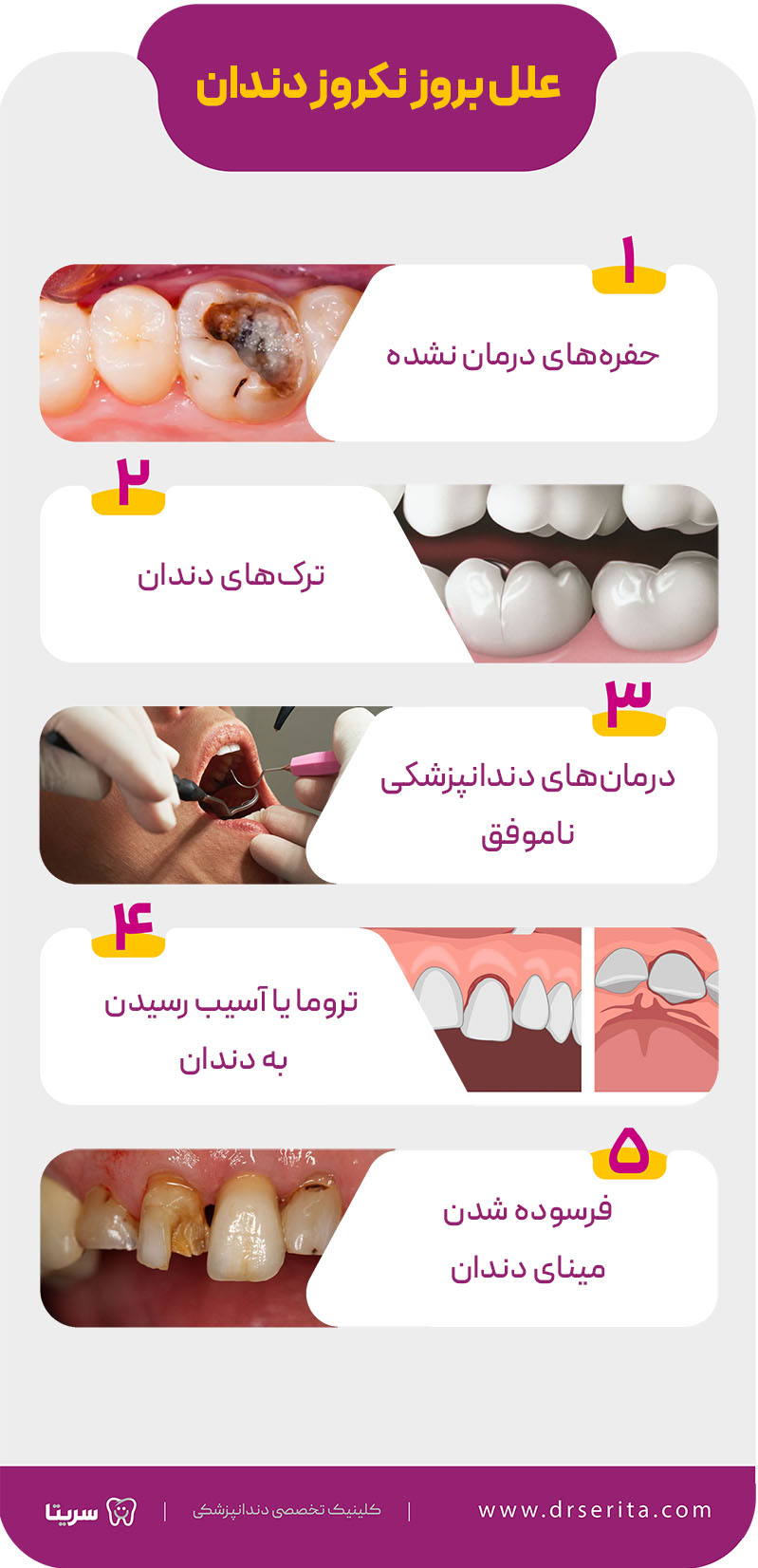 علل بروز نکروز دندان