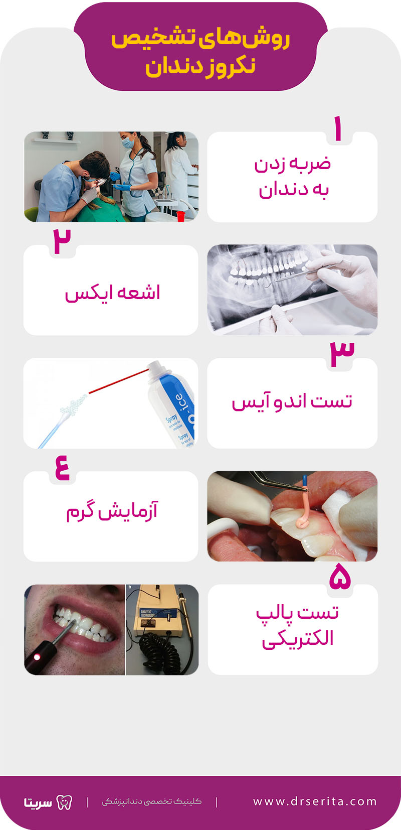 روش های تشخیص نکروز دندان