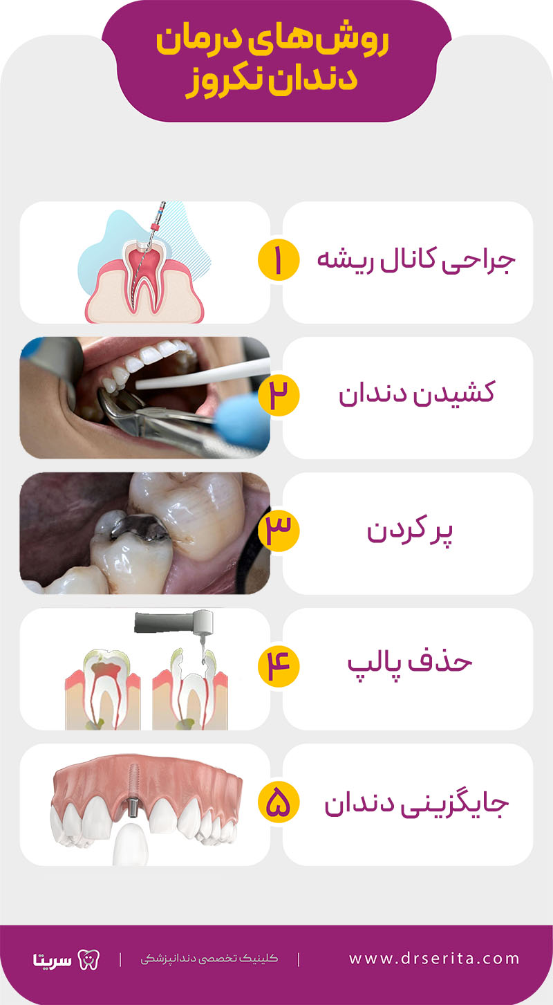 روش های درمان نکروز دندان